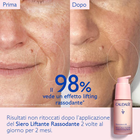 Resveratrol-lift ricarica siero liftante rassodante 2024 30ml Resveratrol-lift ricarica siero liftante rassodante 2024 30ml