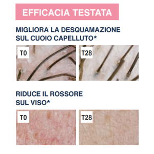 Rilastil difesa dermatite seborroica gel lenitivo sebonormalizzante 30 ml