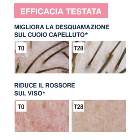 Rilastil difesa dermatite seborroica gel lenitivo sebonormalizzante 30 ml