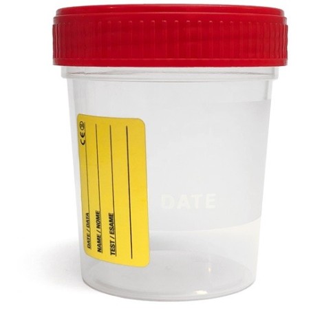 Contenitore per urina sterile guacci capienza 120ml