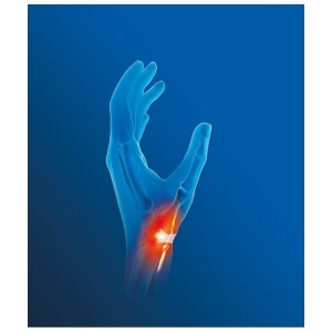 Tutore polso/pollice per tendinite epitact querv'activ sinistro m
