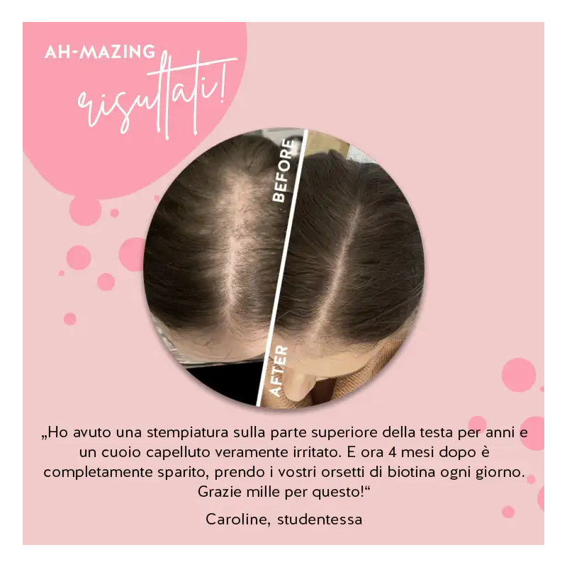 Ah-mazing hair vitamins mit biotin sugarfree 45 caramelle gommose