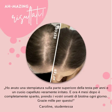 Ah-mazing hair vitamins mit biotin sugarfree 45 caramelle gommose