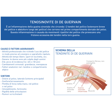 Tutore polso/pollice per tendinite epitact querv'immo destrom