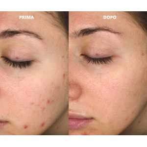 Goovi detergente pelli miste 140 ml