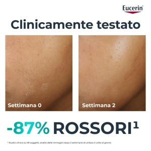 Eucerin Dermopure Clinical Trattamento Lenitivo 40 Ml