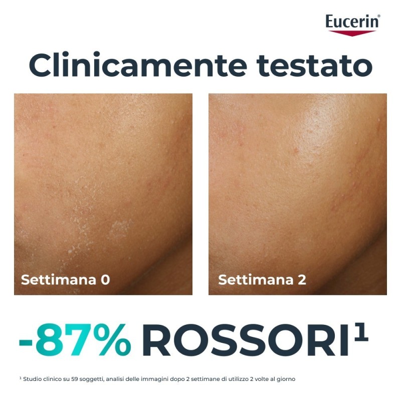 Eucerin Dermopure Clinical Trattamento Lenitivo 40 Ml
