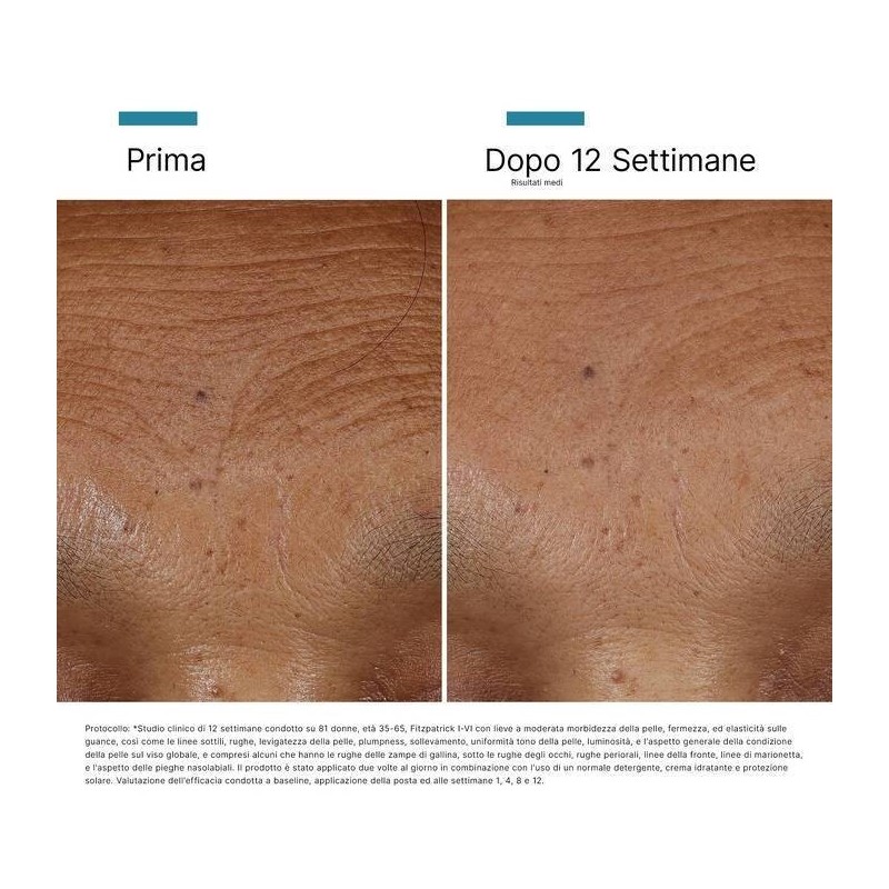 Ha Intensifier Mod 30 Ml