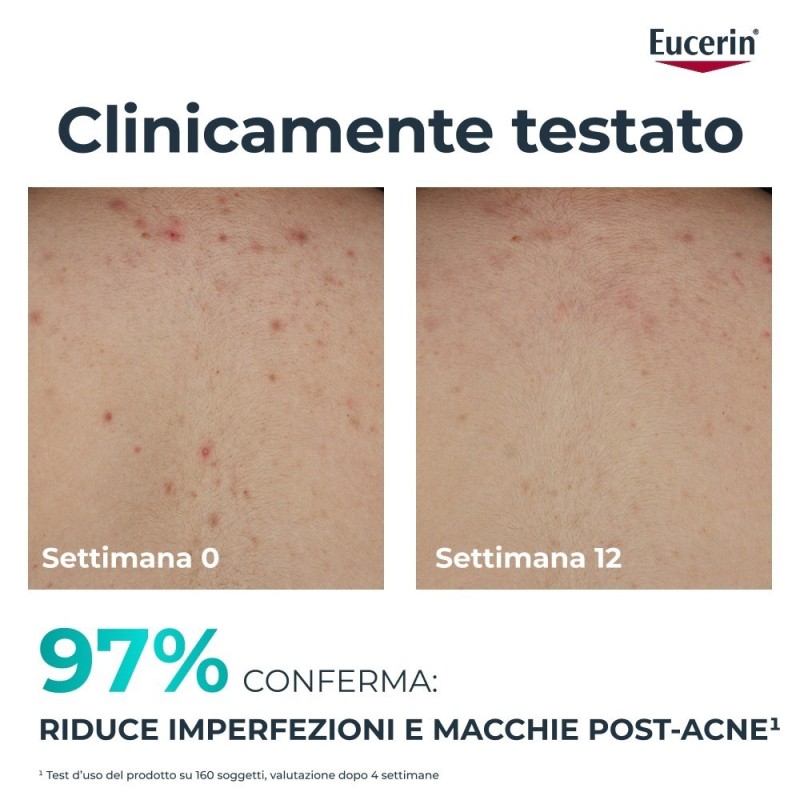 Eucerin Dermopure Clinical Crema Corpo Tripla Azione 200 Ml