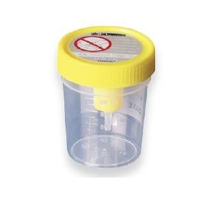 Contenitore urina sterile medipresteril con sistema transfert per provette sottovuoto