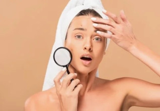 Macchie cutanee: cause, prevenzione e rimedi efficaci